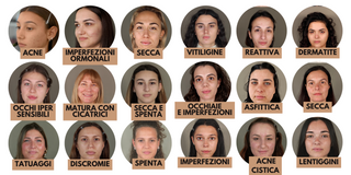 True Corrective - Corso Make Up online su Pelli Problematiche 1 - Vitiligine, Pelle Reattiva, Dermatite, Occhi iper Sensibili